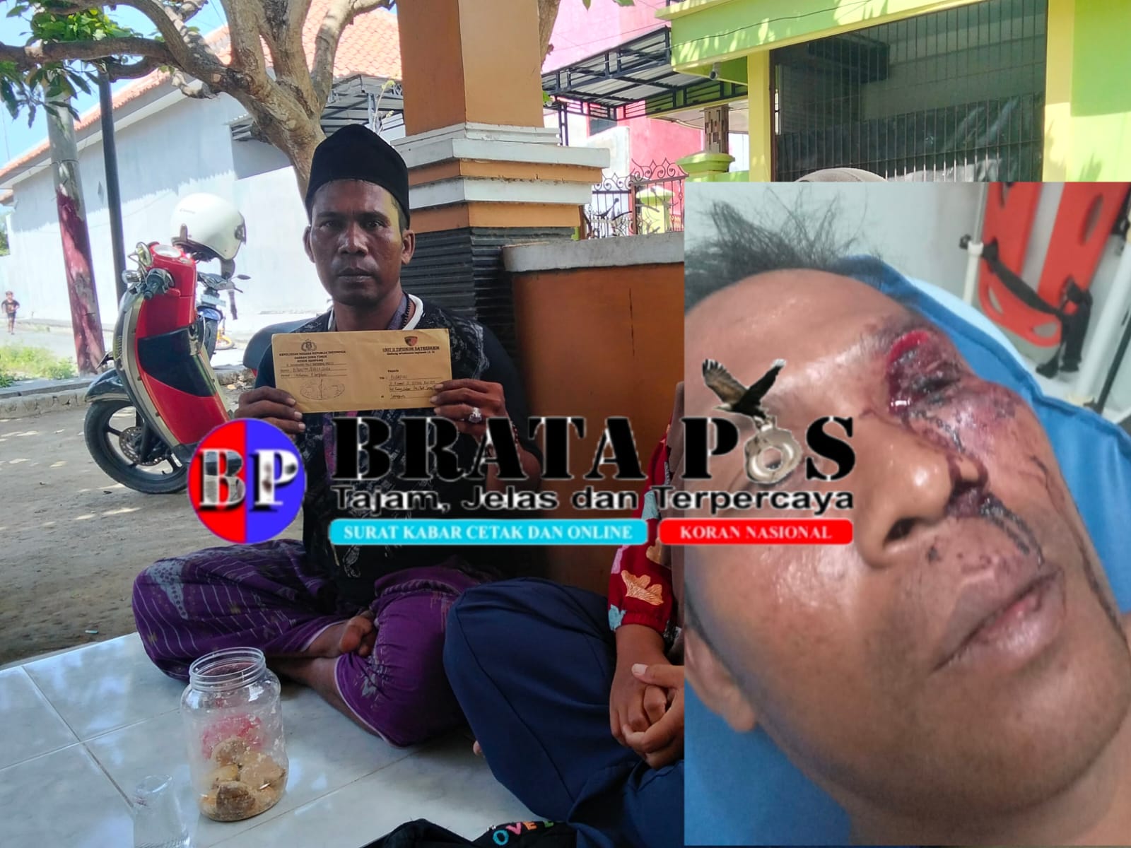 Pelaku Penganiyaan Terhadap Seorang Petani Masih Berkeliaran, Kinerja Polisi Dipertanyakan.