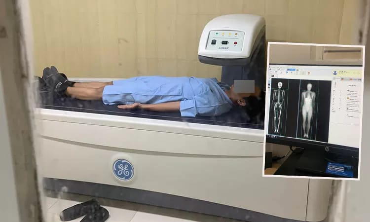 RSUD Bangil Resmi Mengoperasikan Alat DeXa Scan untuk Mendeteksi Tulang ...